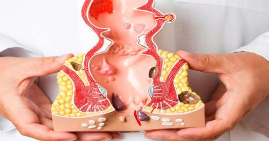 Can Ayurvedic cure Piles and Fissures