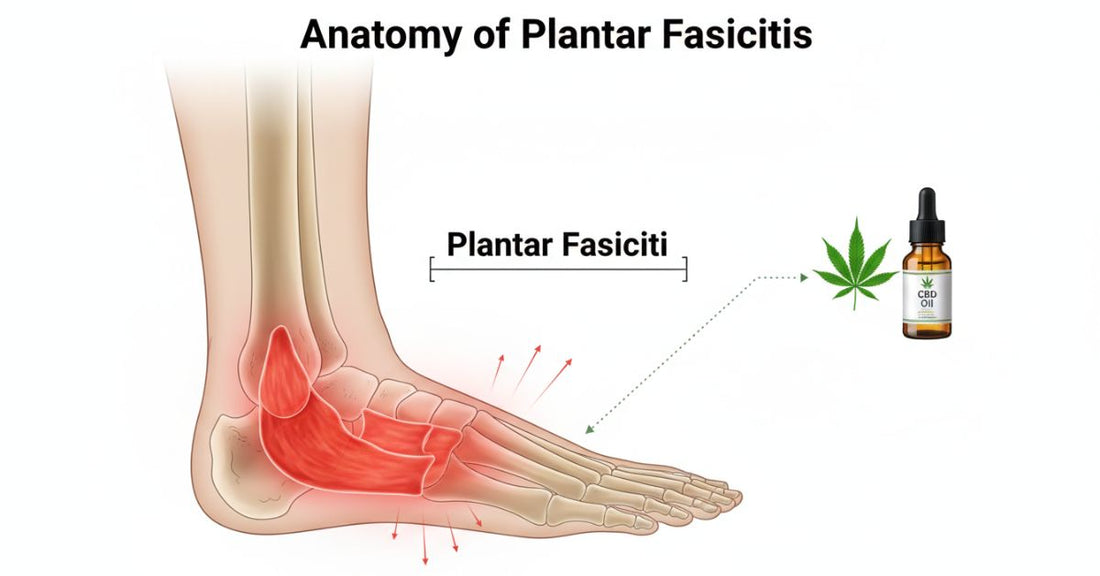 CBD Oil For Plantar Fasciitis