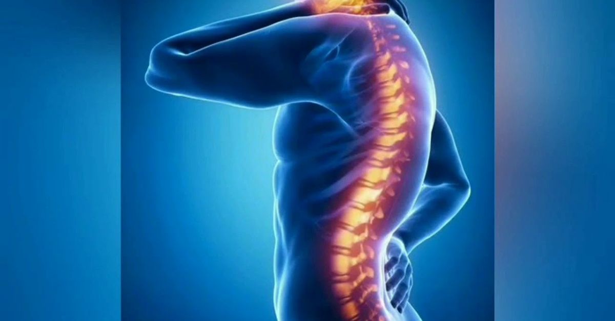 CBD for Spinal Stenosis Pain: Benefits, Dosage, and Natural Relief Gui ...